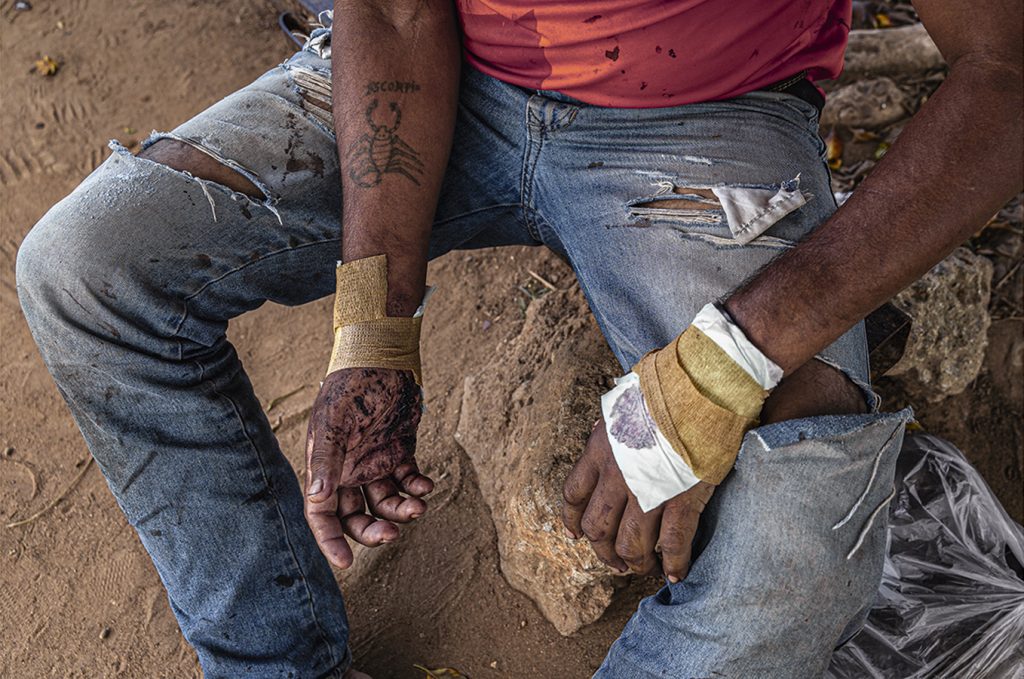 Minas de oro en Venezuela: matanzas, miseria e impunidad